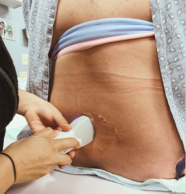 Website+Mission+Statement A close-up of a medical professional performing an ultrasound on a patient's lower back using a handheld ultrasound device. The patient is lying down with their hospital gown partially open, revealing their skin, which has gel applied for the scan. A blue and pink elastic band is visible around the patient’s waist, and the setting appears to be a medical examination room.